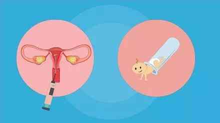人工授精和试管婴儿是一回事吗，二者有何区别?
