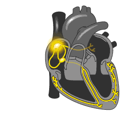 心电图报告上的窦性心律不齐是什么意思？有两类人需要注意